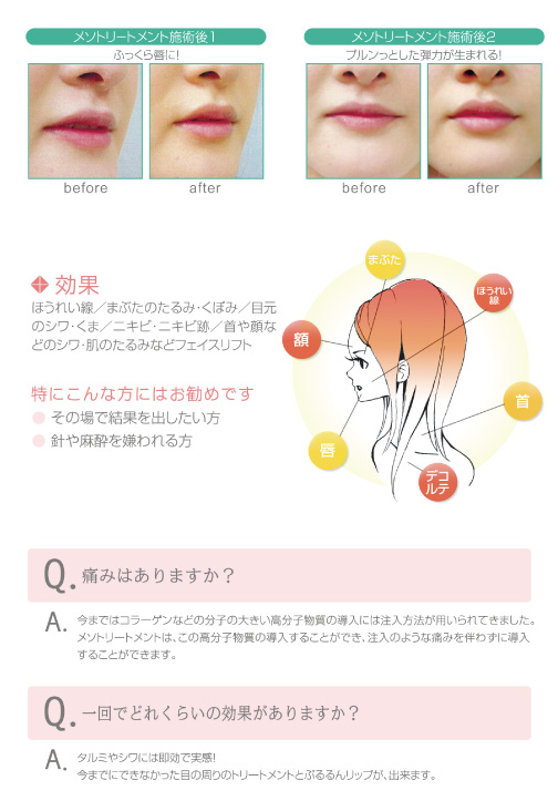 効果やQ&A